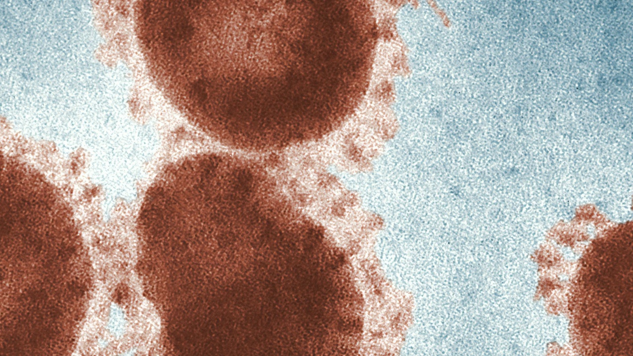 Russland warnt vor indischer Ausbruch des Nipah-Virus