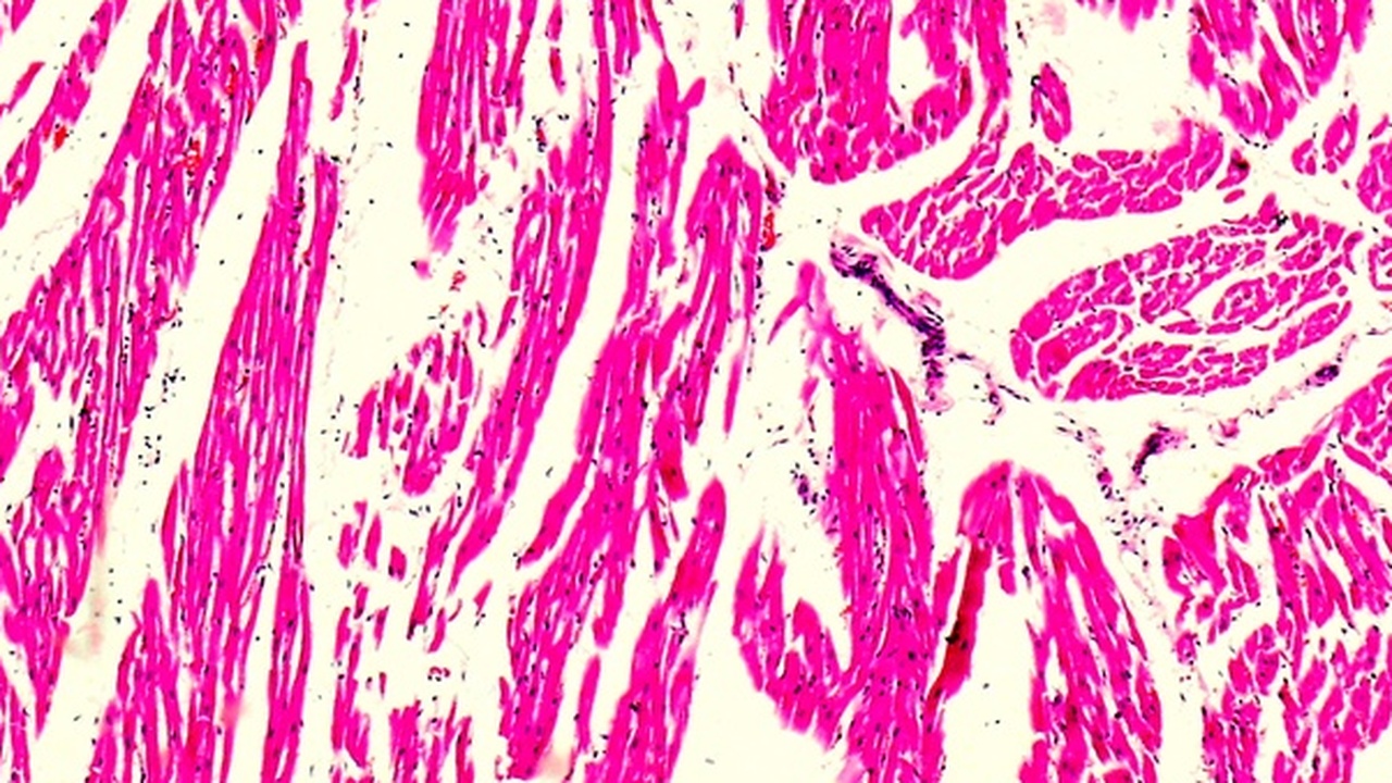 mRNA-Impfstoffe verursachen Myokarditis und Autoimmunerkrankungen
