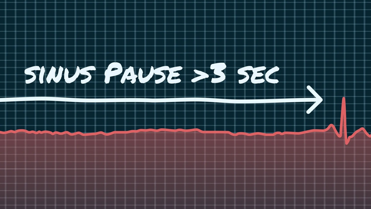 US-Notenbank verlängert Zinspause trotz wachsender Inflationsrisiken